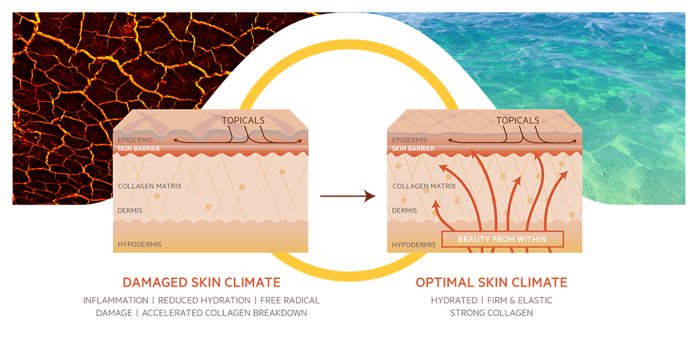 Diagram showing Damaged Skin Climate - Inflammation, Reduced Hydration, Free Radical Damage, Accelerated Collagen Breakdown. Optimal Skin Climate - Hydrated, Firm and Elastic, Strong Collagen